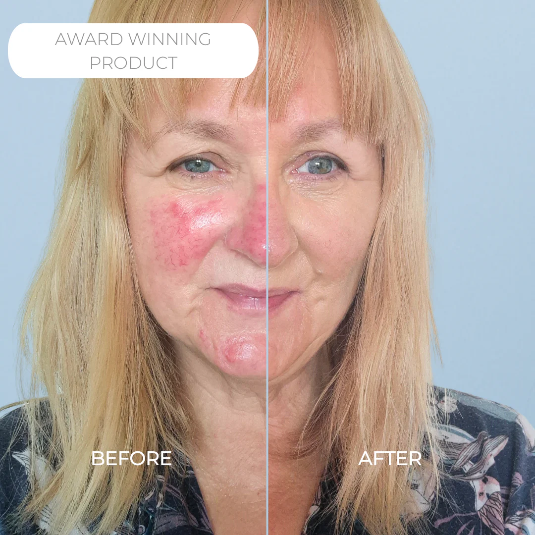 Rosalique 3 in 1 Anti-Redness Miracle Formula SPF50 - Image 3